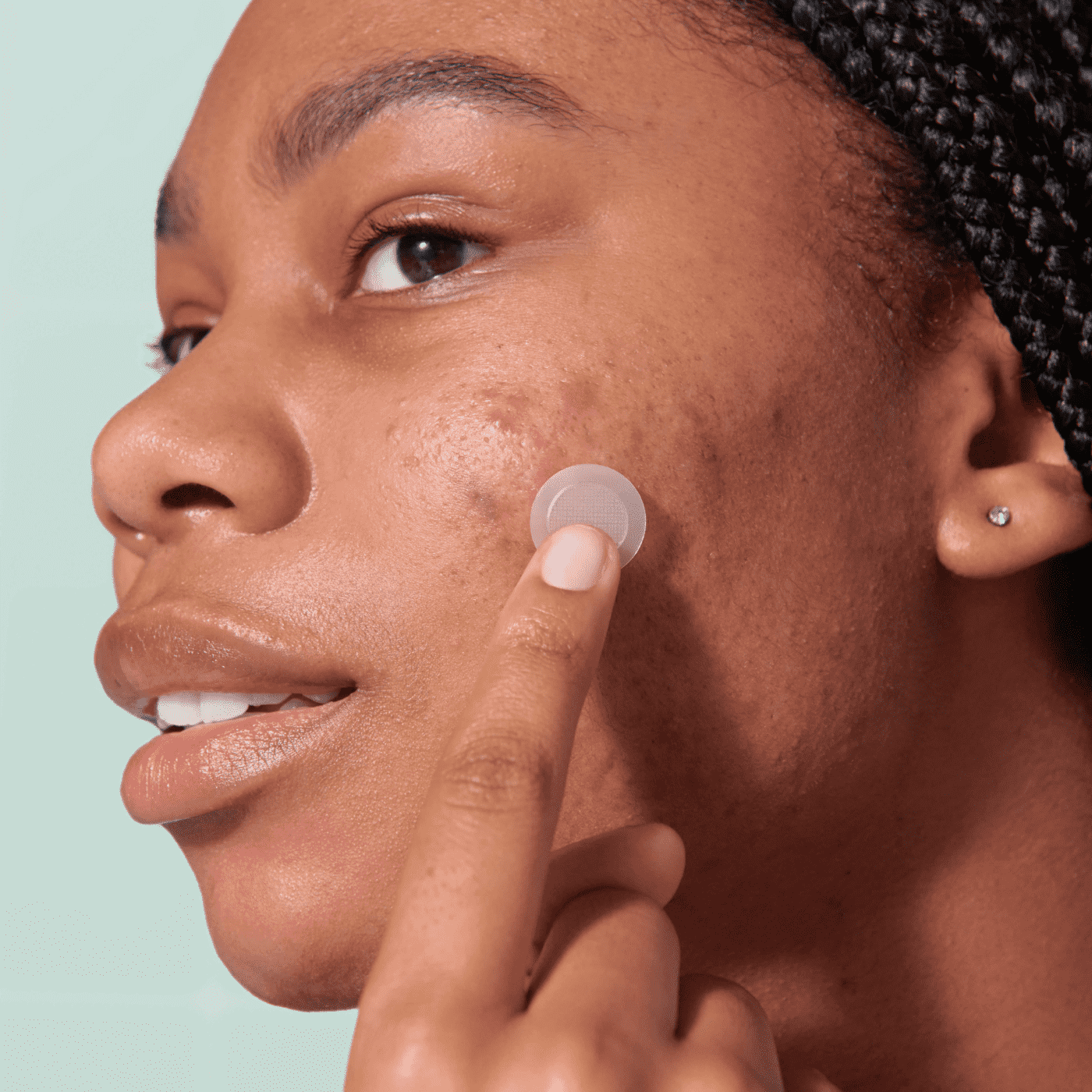 Mighty Patch™ for Early-Stage Blemishes - Easy Pick
