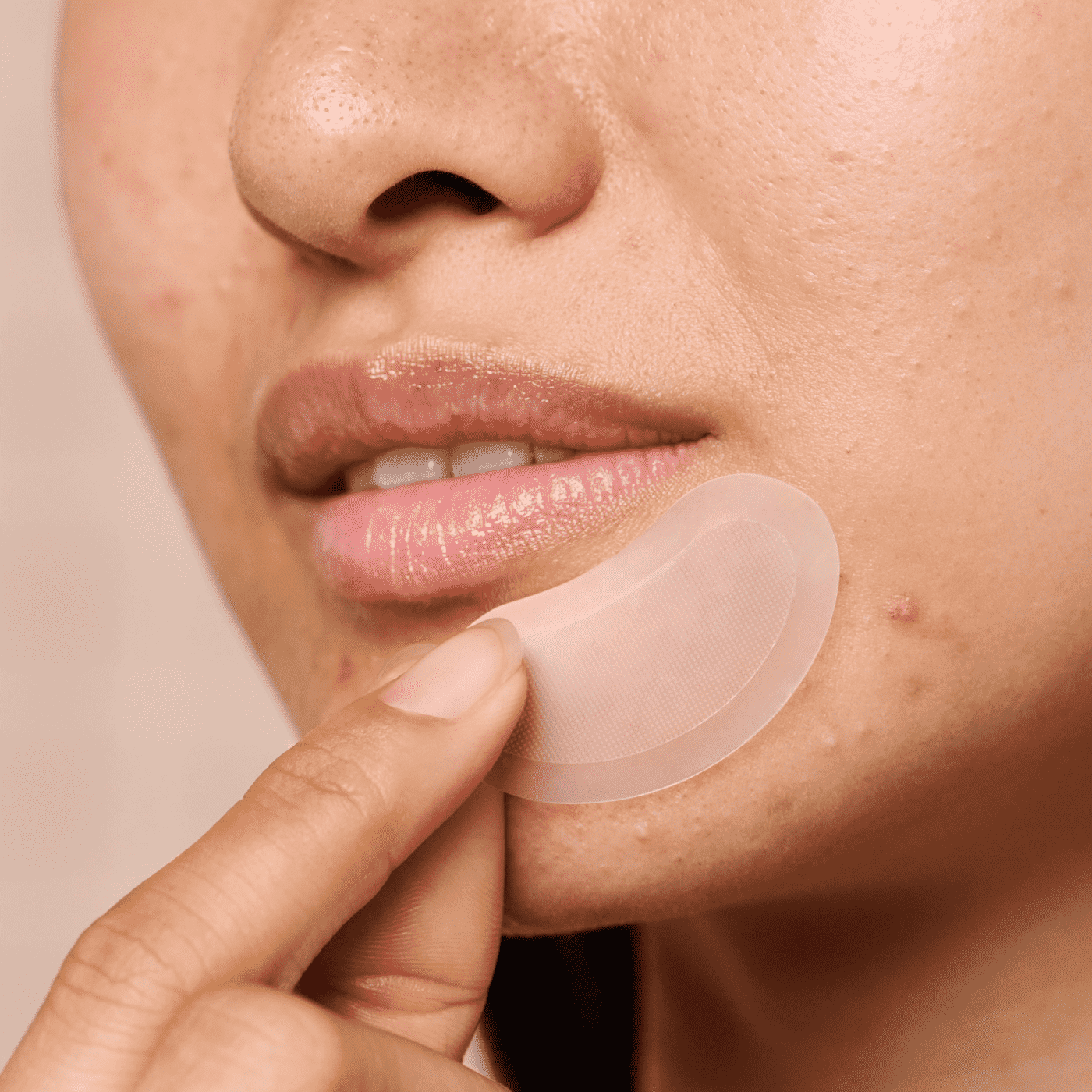 Mighty Patch™ for XL Early-Stage Blemishes - Modern Choice